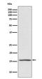 Phorbol-12-Myristate-13-Acetate-Induced Protein 1 antibody, M02287, Boster Biological Technology, Western Blot image 