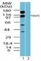 Thyroid Hormone Receptor Associated Protein 3 antibody, PA5-23145, Invitrogen Antibodies, Western Blot image 