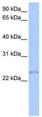 Transcription Elongation Factor A Like 1 antibody, TA339102, Origene, Western Blot image 