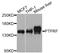 Protein Tyrosine Phosphatase Receptor Type F antibody, STJ27397, St John