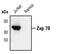 Zeta Chain Of T Cell Receptor Associated Protein Kinase 70 antibody, MA5-15137, Invitrogen Antibodies, Western Blot image 