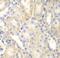 DLC1 Rho GTPase Activating Protein antibody, FNab02405, FineTest, Immunohistochemistry paraffin image 