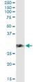 CD83 Molecule antibody, H00009308-M01, Novus Biologicals, Immunoprecipitation image 