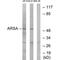 Arylsulfatase A antibody, PA5-49983, Invitrogen Antibodies, Western Blot image 