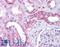 Signal Induced Proliferation Associated 1 Like 1 antibody, LS-B5053, Lifespan Biosciences, Immunohistochemistry paraffin image 