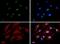 A-Kinase Anchoring Protein 8 antibody, PA5-72980, Invitrogen Antibodies, Immunofluorescence image 