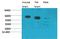 Cholecystokinin B Receptor antibody, STJ97559, St John