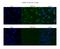 Cleavage And Polyadenylation Specific Factor 6 antibody, A04551, Boster Biological Technology, Immunohistochemistry paraffin image 