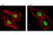 RAD18 E3 Ubiquitin Protein Ligase antibody, 9040T, Cell Signaling Technology, Immunocytochemistry image 