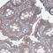 AarF Domain Containing Kinase 1 antibody, NBP2-14267, Novus Biologicals, Immunohistochemistry frozen image 