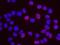 Minichromosome Maintenance Complex Component 7 antibody, GTX23732, GeneTex, Proximity Ligation Assay image 