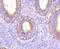 Matrix Metallopeptidase 14 antibody, NBP2-67415, Novus Biologicals, Immunohistochemistry paraffin image 