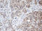 ADP Ribosylation Factor Like GTPase 2 Binding Protein antibody, LS-C175257, Lifespan Biosciences, Immunohistochemistry paraffin image 