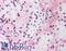 HIF1-alpha antibody, LS-C140776, Lifespan Biosciences, Immunohistochemistry frozen image 