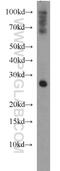 Synaptosome Associated Protein 25 antibody, 14903-1-AP, Proteintech Group, Western Blot image 