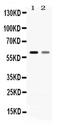 Solute Carrier Family 1 Member 3 antibody, PA5-80012, Invitrogen Antibodies, Western Blot image 