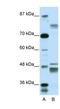 Zinc Finger Protein 607 antibody, NBP1-80125, Novus Biologicals, Western Blot image 