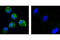 Platelet Derived Growth Factor Receptor Alpha antibody, 3174T, Cell Signaling Technology, Immunofluorescence image 