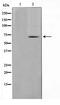 Transforming Growth Factor Beta Receptor 2 antibody, TA347477, Origene, Western Blot image 