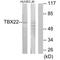T-Box 22 antibody, A06861, Boster Biological Technology, Western Blot image 