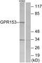 G Protein-Coupled Receptor 153 antibody, A30816, Boster Biological Technology, Western Blot image 