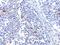 Interferon Induced With Helicase C Domain 1 antibody, NBP1-76761, Novus Biologicals, Immunohistochemistry paraffin image 