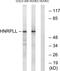 Heterogeneous Nuclear Ribonucleoprotein L Like antibody, PA5-39205, Invitrogen Antibodies, Western Blot image 