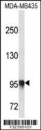 Procollagen-Lysine,2-Oxoglutarate 5-Dioxygenase 3 antibody, 56-612, ProSci, Western Blot image 