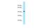 Zinc Finger HIT-Type Containing 2 antibody, A16154, Boster Biological Technology, Western Blot image 