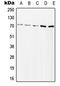 Zeta Chain Of T Cell Receptor Associated Protein Kinase 70 antibody, GTX32280, GeneTex, Western Blot image 