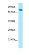 NUAK Family Kinase 1 antibody, orb331295, Biorbyt, Western Blot image 