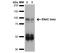 Sodium Channel Epithelial 1 Beta Subunit antibody, NBP2-59380, Novus Biologicals, Western Blot image 