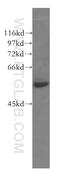 C1q And TNF Related 6 antibody, 51030-1-AP, Proteintech Group, Western Blot image 