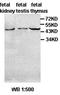 Arylacetamide Deacetylase Like 4 antibody, orb77458, Biorbyt, Western Blot image 