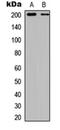 TSC Complex Subunit 2 antibody, orb304648, Biorbyt, Western Blot image 