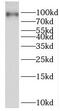 PBX Homeobox Interacting Protein 1 antibody, FNab06185, FineTest, Western Blot image 