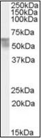 Thyroid Hormone Receptor Alpha antibody, orb89620, Biorbyt, Western Blot image 