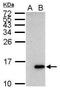 Galectin 7B antibody, PA5-31866, Invitrogen Antibodies, Western Blot image 
