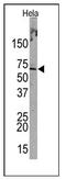 Probable transcription factor PML antibody, AP12217PU-N, Origene, Western Blot image 