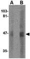 Sirtuin 2 antibody, GTX31336, GeneTex, Western Blot image 