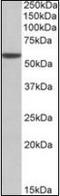 Aldehyde Dehydrogenase 3 Family Member A1 antibody, orb137626, Biorbyt, Western Blot image 