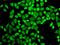 Interleukin 7 Receptor antibody, GTX54311, GeneTex, Immunofluorescence image 