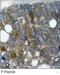 Heat Shock Protein Family B (Small) Member 1 antibody, GTX38674, GeneTex, Immunohistochemistry paraffin image 