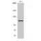 Signal Transducer And Activator Of Transcription 2 antibody, LS-C381211, Lifespan Biosciences, Western Blot image 