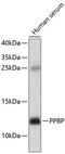Pro-Platelet Basic Protein antibody, 18-389, ProSci, Western Blot image 