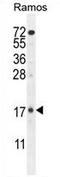 Tetratricopeptide Repeat Domain 9C antibody, AP54404PU-N, Origene, Western Blot image 