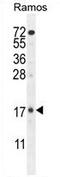 Tetratricopeptide Repeat Domain 9C antibody, AP54404PU-N, Origene, Western Blot image 