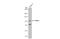 Forkhead Box P2 antibody, GTX135298, GeneTex, Western Blot image 