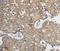 Protein Phosphatase, Mg2+/Mn2+ Dependent 1B antibody, LS-C332372, Lifespan Biosciences, Immunohistochemistry paraffin image 