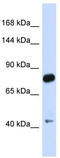 Cadherin Related 23 antibody, TA338484, Origene, Western Blot image 